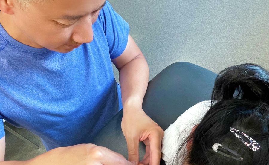 dry needling physiotherapist in burnaby