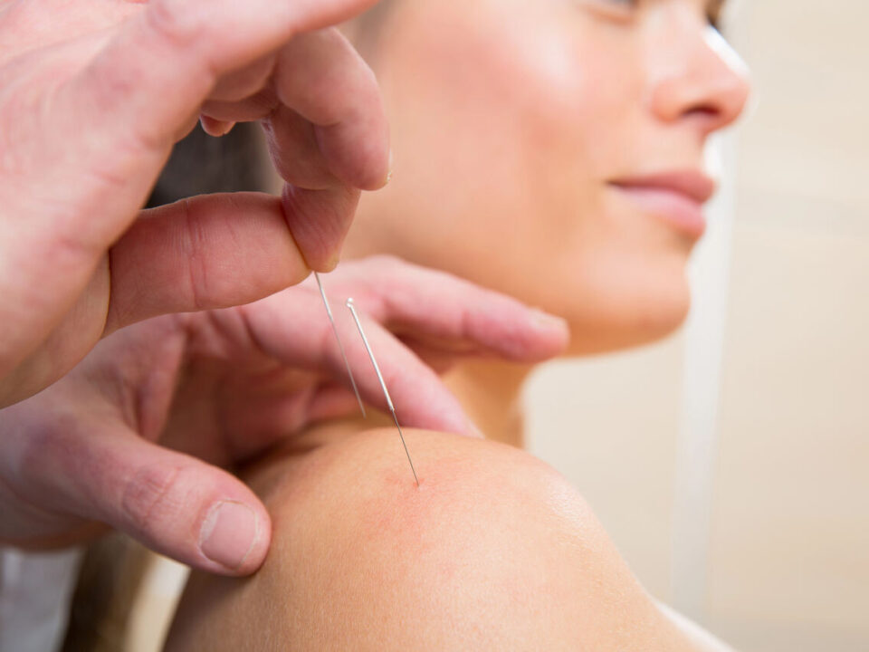acupuncture for shoulder pain burnaby