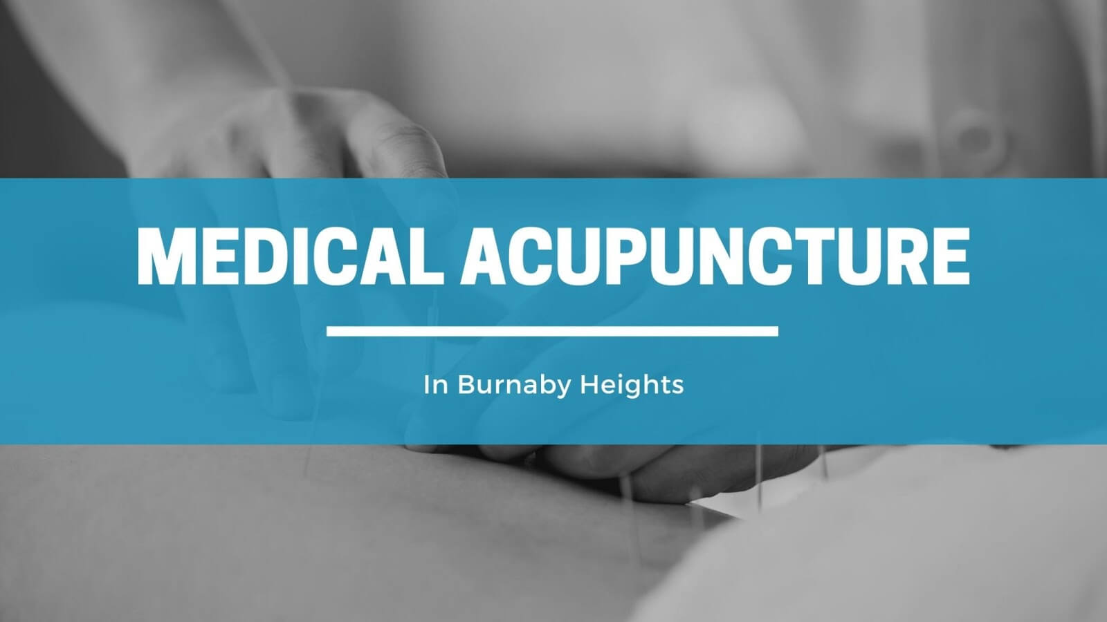acupuncture burnaby