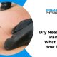 Dry Needling for Pain Burnaby
