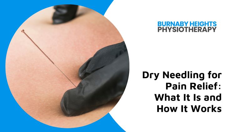 Best Ways to Ease Pain Using Dry Needling » Heartland Rehab