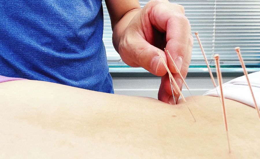 acupuncture clinic burnaby