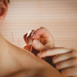 acupuncture benefits burnaby