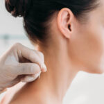 benefits of acupuncture burnaby