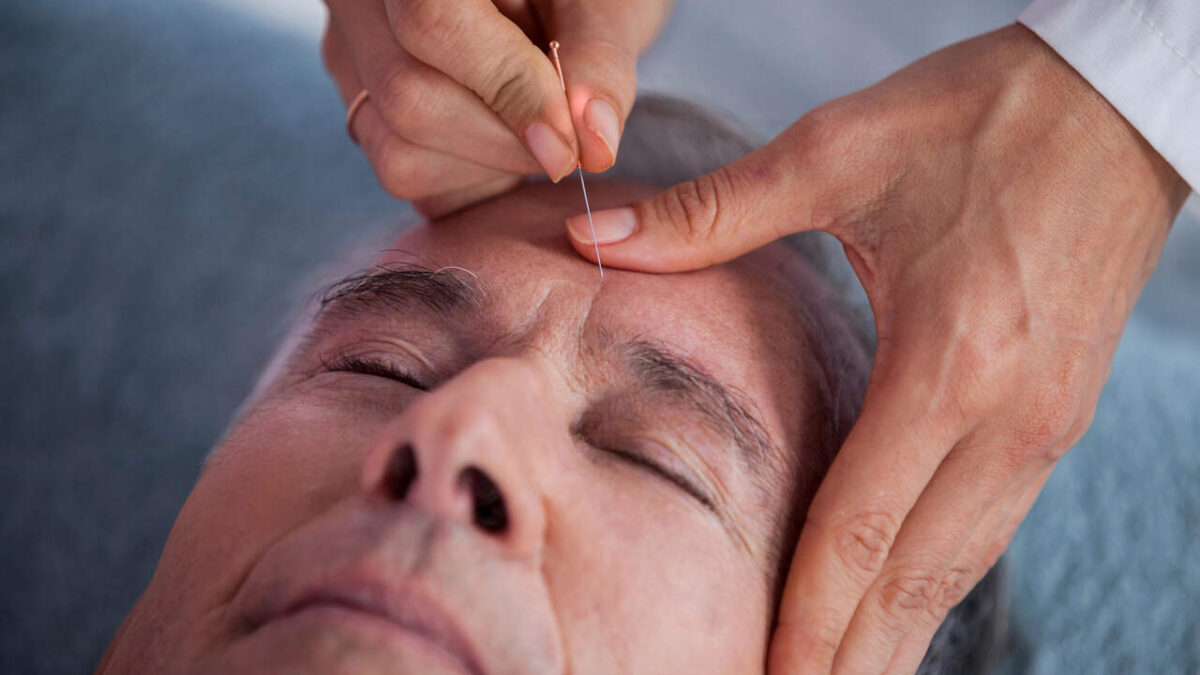 is acupuncture safe burnaby