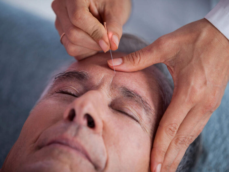 is acupuncture safe burnaby