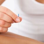 customizing acupuncture plans burnaby