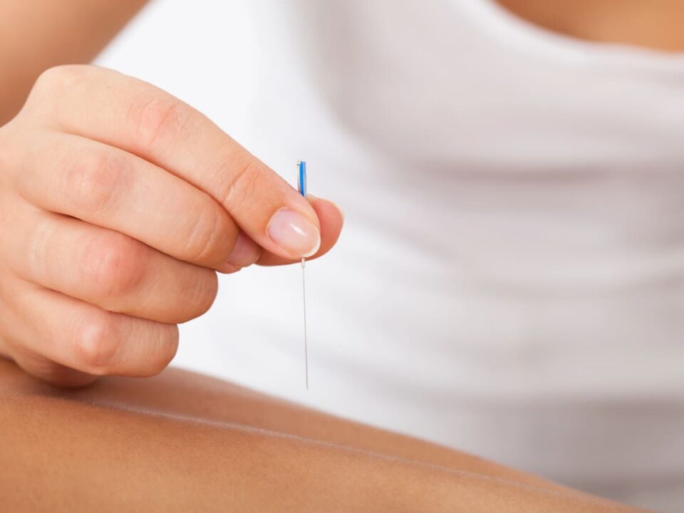 customizing acupuncture plans burnaby