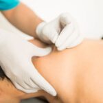 tips for supporting acupuncture burnaby
