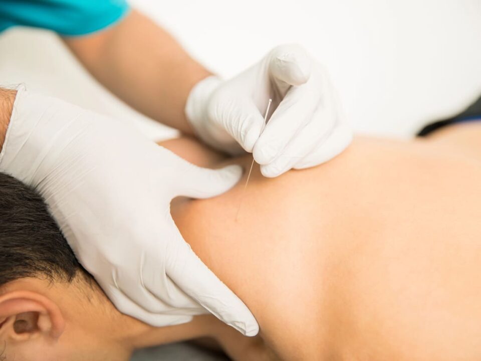 tips for supporting acupuncture burnaby