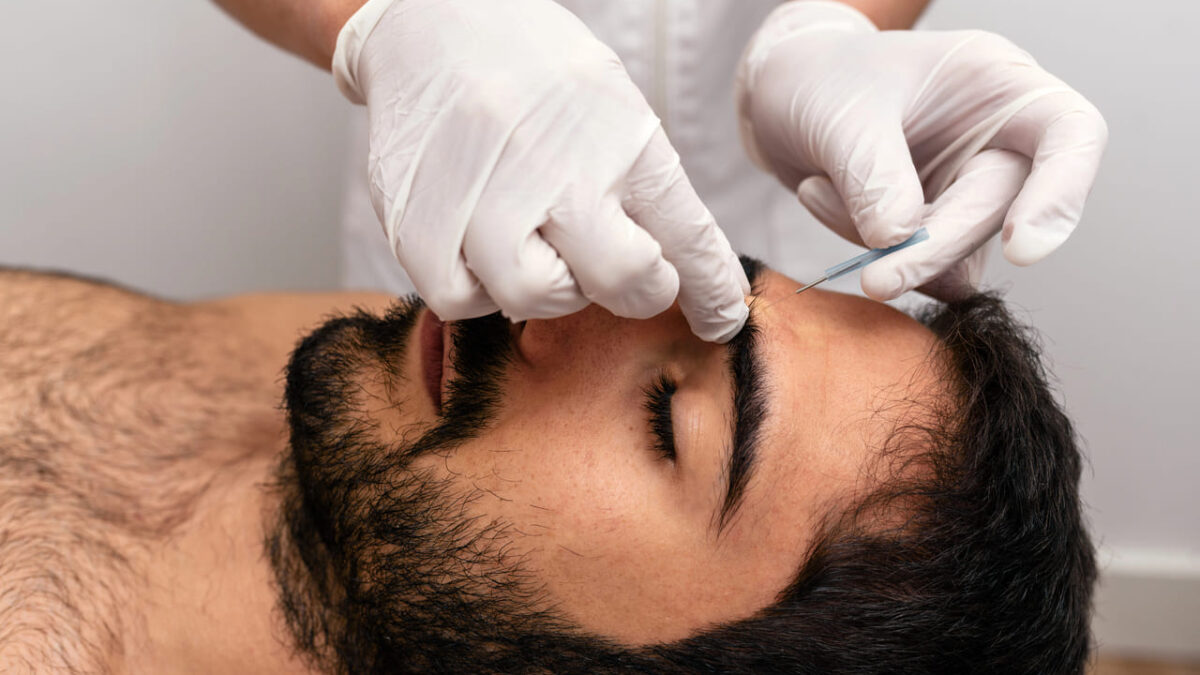 what to expect during acupuncture sessions burnaby