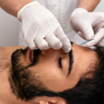 what to expect during acupuncture sessions burnaby