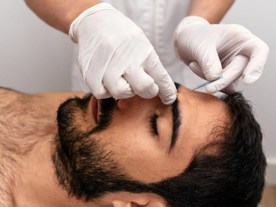 what to expect during acupuncture sessions burnaby