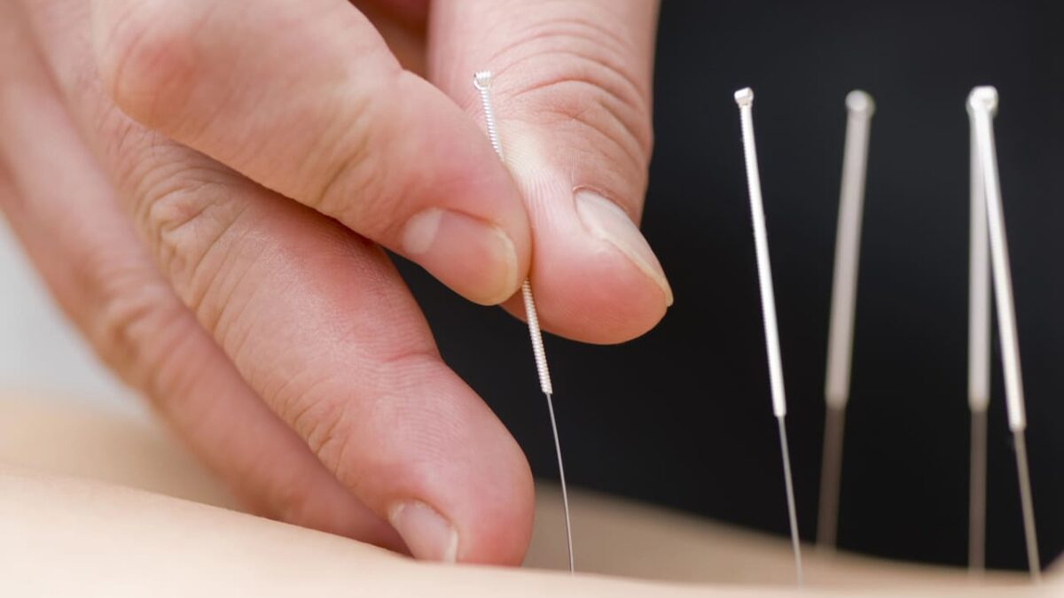 the role of education in acupuncture burnaby