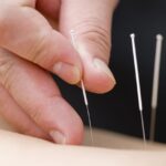 the role of education in acupuncture burnaby