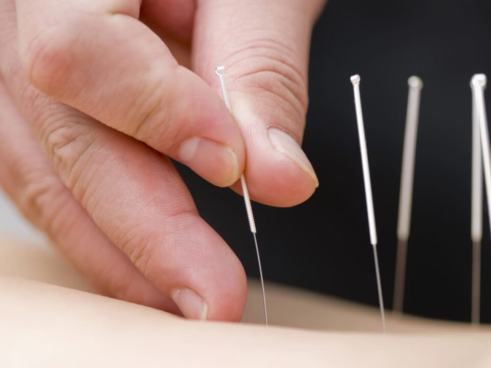 the role of education in acupuncture burnaby