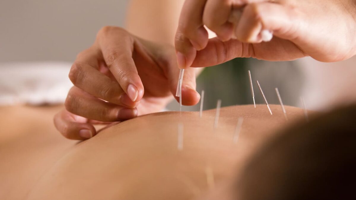 is acupuncture good for back pain