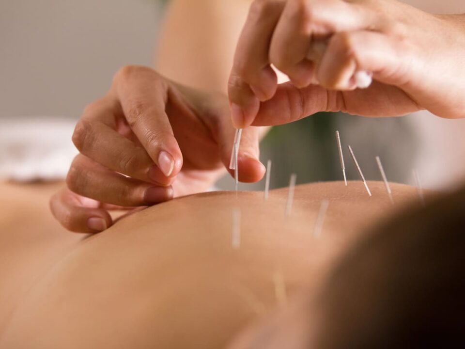 is acupuncture good for back pain